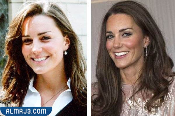 كيت ميدلتون قبل وبعد
