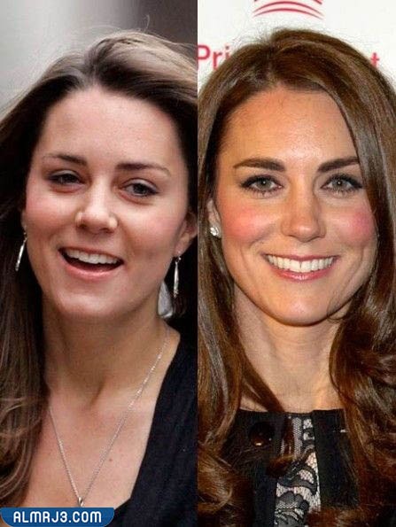 كيت ميدلتون قبل وبعد