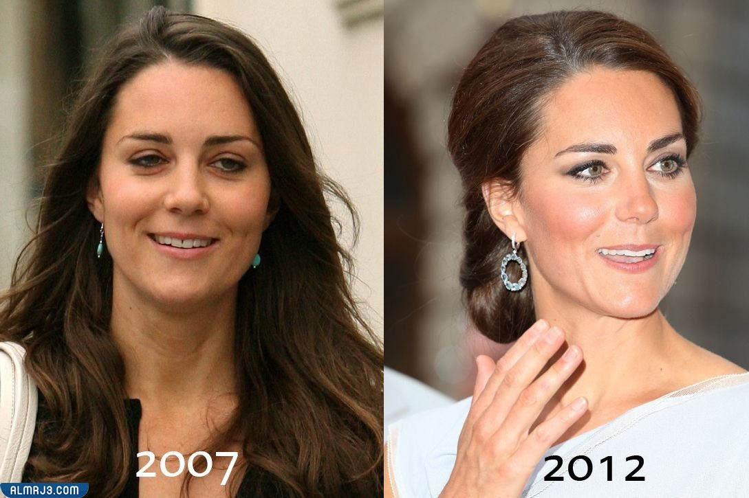 كيت ميدلتون قبل وبعد