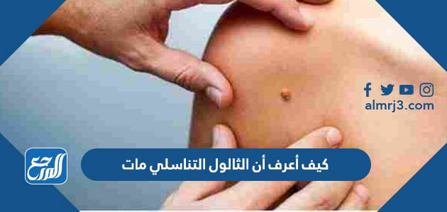 كيف أعرف أن الثالول التناسلي مات