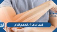 كيف اعرف أن العظم التأم