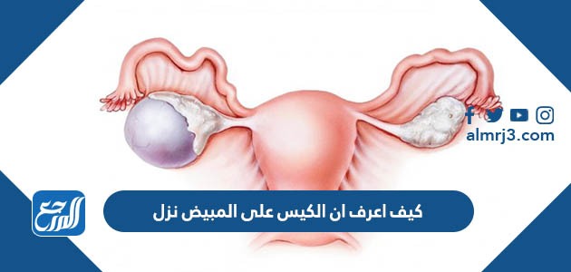 كيف اعرف ان الكيس على المبيض نزل