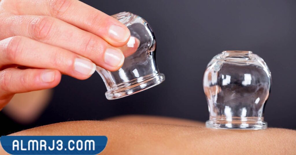 ما الواجب على المحتجم قبل و بعد الحجامة 1