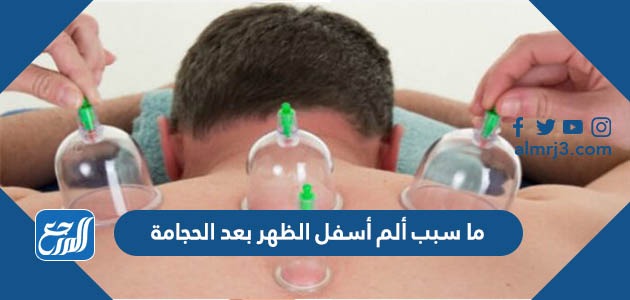 ما سبب ألم أسفل الظهر بعد الحجامة