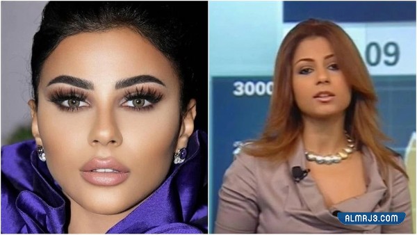 مهيرة عبدالعزيز قبل وبعد التجميل