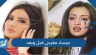 ميساء مغربي قبل وبعد ميساء مغربي قبل وبعد