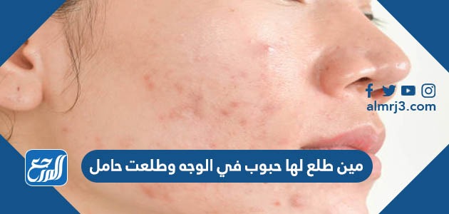 مين طلع لها حبوب في الوجه وطلعت حامل