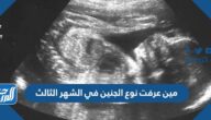 مين عرفت نوع الجنين في الشهر الثالث مين عرفت نوع الجنين في الشهر الثالث