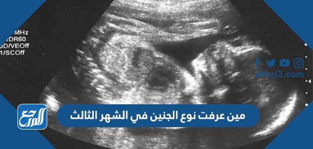 مين عرفت نوع الجنين في الشهر الثالث