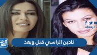 نادين الراسي قبل وبعد