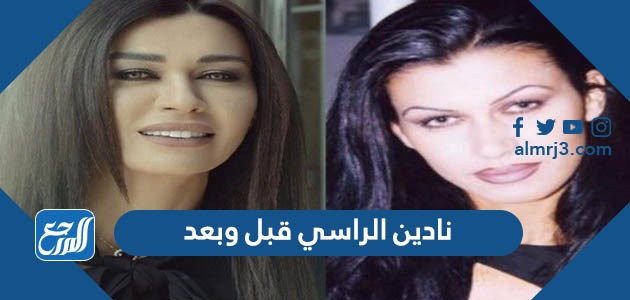 نادين الراسي قبل وبعد