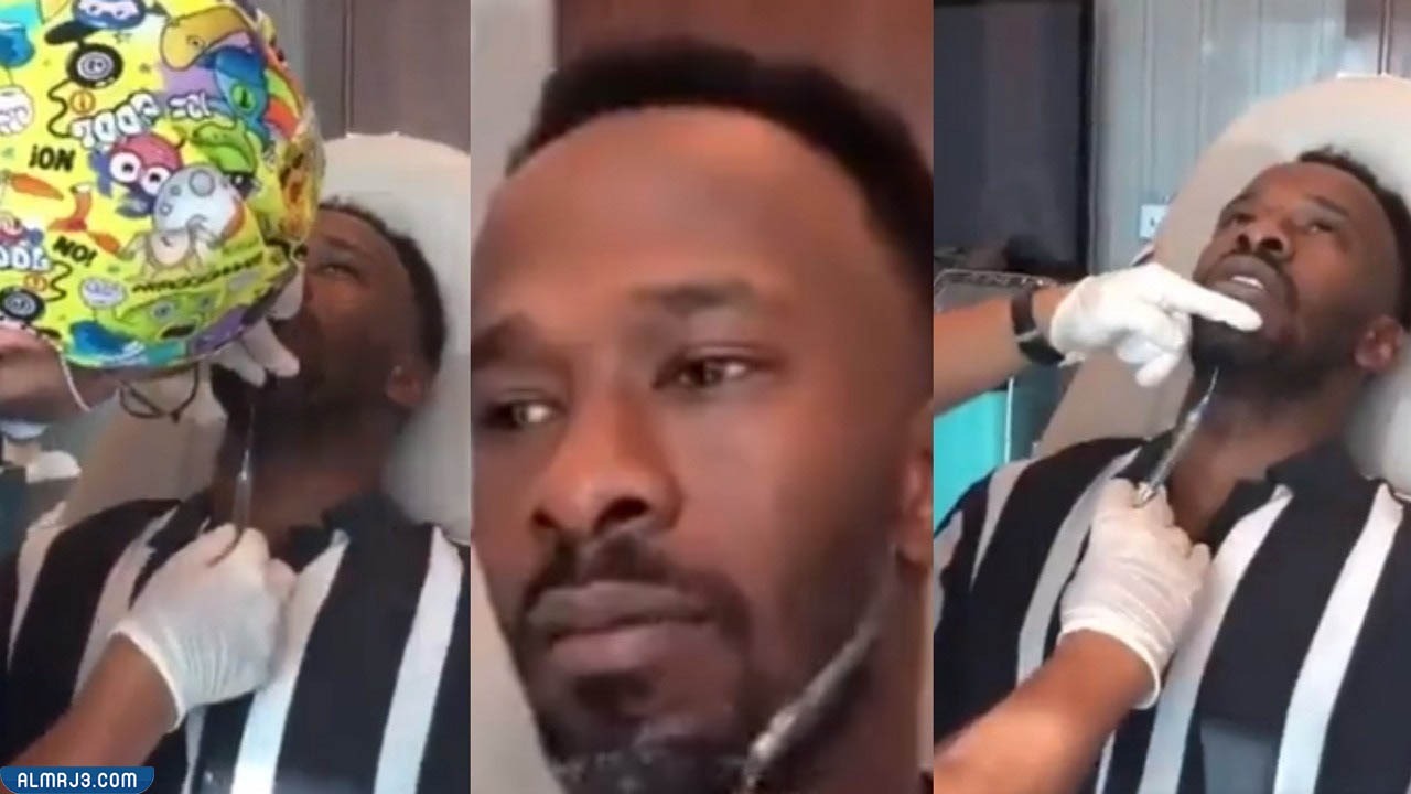 هل أجرى فهد المولد عملية تجميل