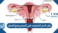 هل الدم المتجمد في الرحم يمنع الحمل
