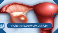 هل الكيس علي المبيض يسبب نزول دم
