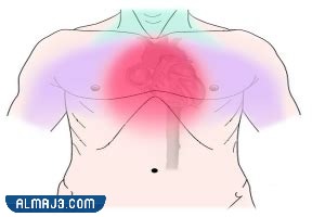 نصائح تساعد تخفيف الغصة في وسط القفص الصدري