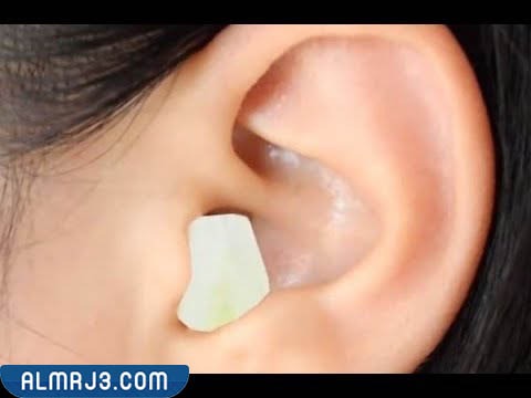 فوائد الثوم لعلاج الاذن 