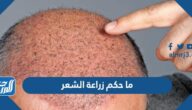 ما حكم زراعة الشعر