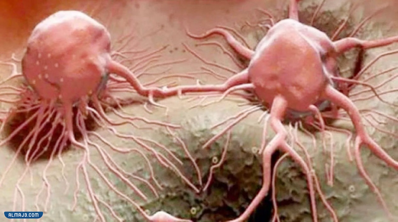 أنواع السرطانات الوراثية 