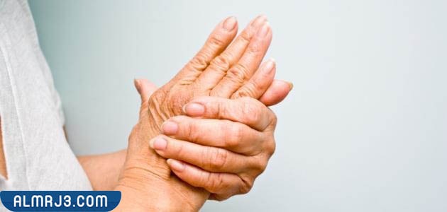 الأشخاص الأكثر عرضه للإصابة بانتفاخ عروق اليدين اليمنى 