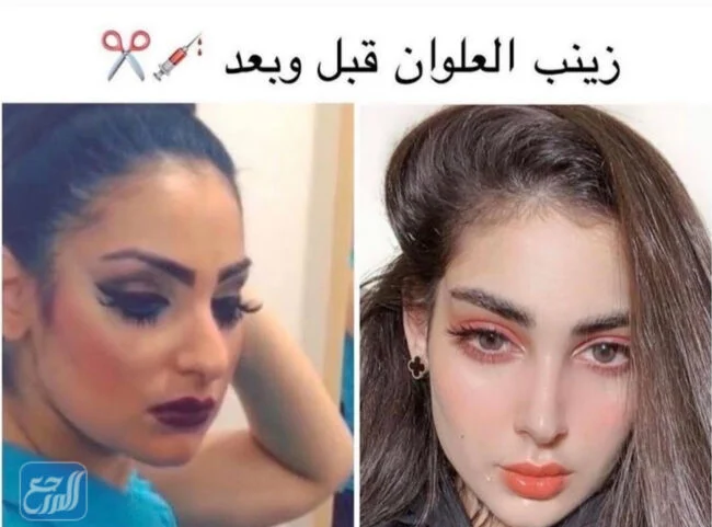 صور زينب العلوان قبل التجميل