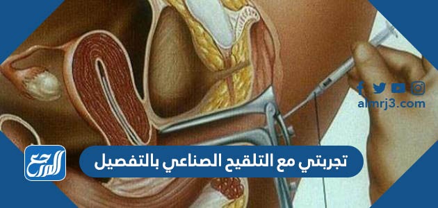 تجربتي مع التلقيح الصناعي بالتفصيل
