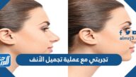 تجربتي مع عملية تجميل الأنف