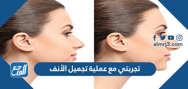 تجربتي مع عملية تجميل الأنف