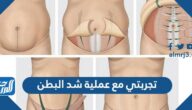 تجربتي مع عملية شد البطن
