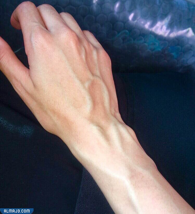 خطوات طيبة لاخفاء عروق اليدين