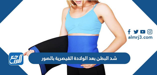 شد البطن بعد الولادة القيصرية بالصور