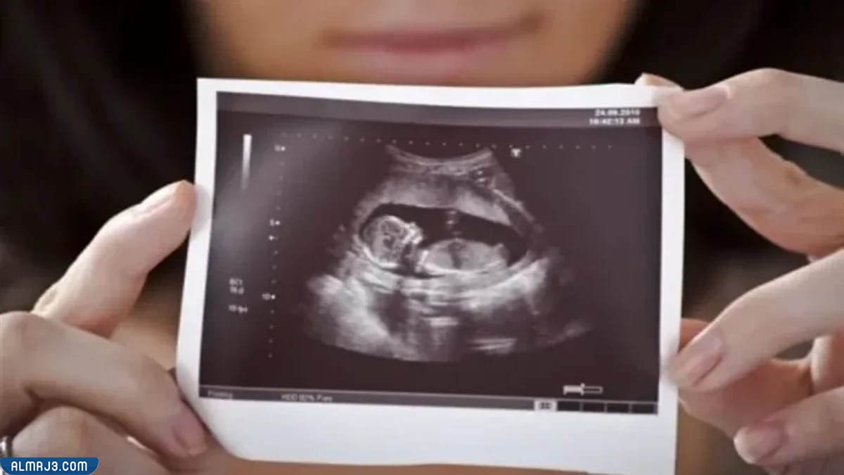 شكل الجنين في الشهر الرابع بالسونار 