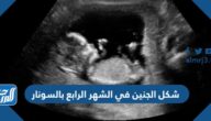 شكل الجنين في الشهر الرابع بالسونار