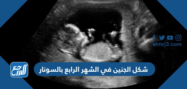شكل الجنين في الشهر الرابع بالسونار