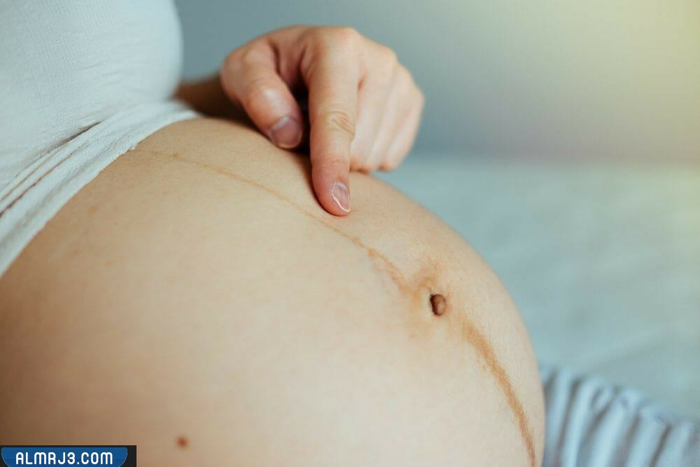شكل خط البطن أثناء الحمل بولد