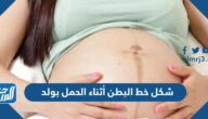 شكل خط البطن أثناء الحمل بولد