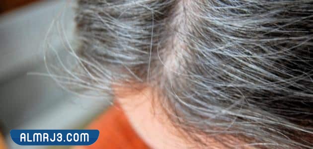 5 أمراض تتسبب في ظهور علامات الشيب المبكر