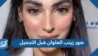 صور زينب العلوان قبل التجميل