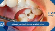 طريقة التخلص من تسوس الأسنان في يوم واحد