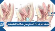 كيف اعرف أن الرحم في مكانه الطبيعي