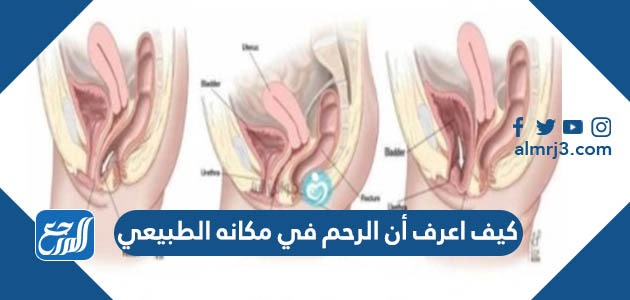 كيف اعرف أن الرحم في مكانه الطبيعي