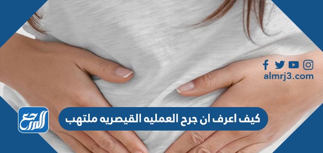 كيف اعرف ان جرح العمليه القيصريه ملتهب