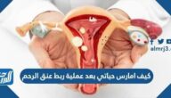 كيف امارس حياتي بعد عملية ربط عنق الرحم