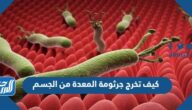 كيف تخرج جرثومة المعدة من الجسم