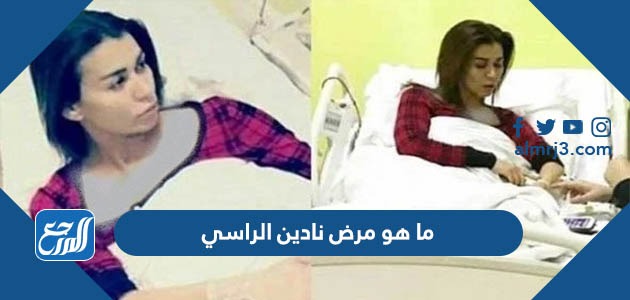 ما هو مرض نادين الراسي