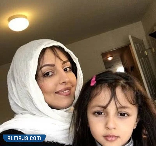 ملاك الحسيني قبل التجميل