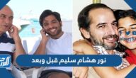 نور هشام سليم قبل وبعد