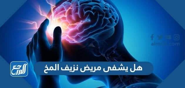 هل يشفى مريض نزيف المخ
