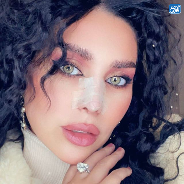 دكتورة خلود بعد عملية التجميل