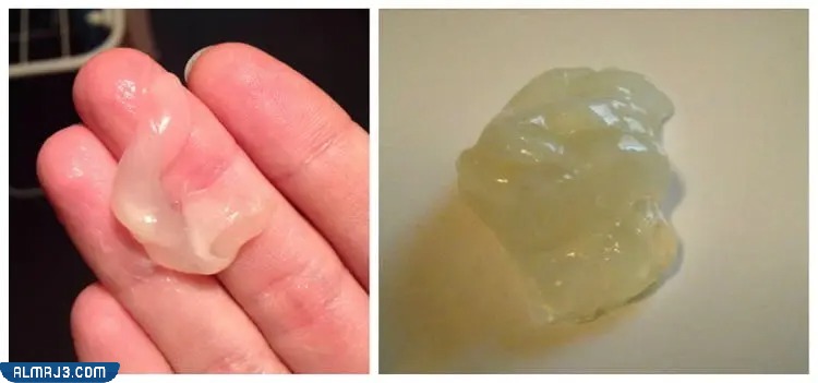 كيف اعرف ان سدادة الرحم نزلت