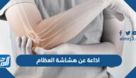 اذاعة عن هشاشة العظام pdf جاهزة للطباعة